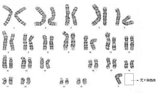 y染色体1.jpg